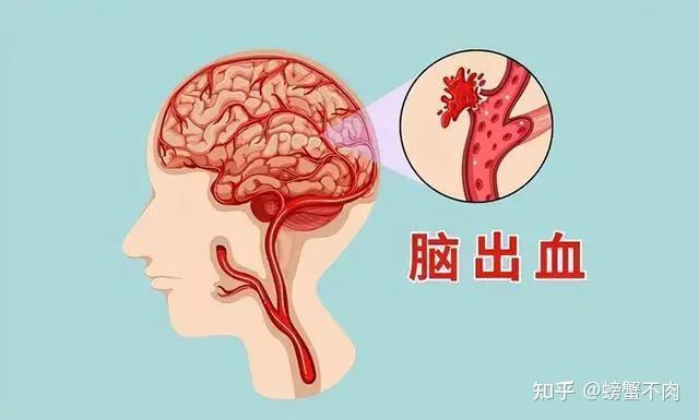 高血压的危害你注意了吗？